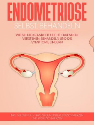 Endometriose selbst behandeln: Wie Sie die Krankheit leicht erkennen